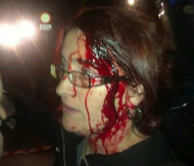 La senadora d'Amaiur Amalur Mendizábal